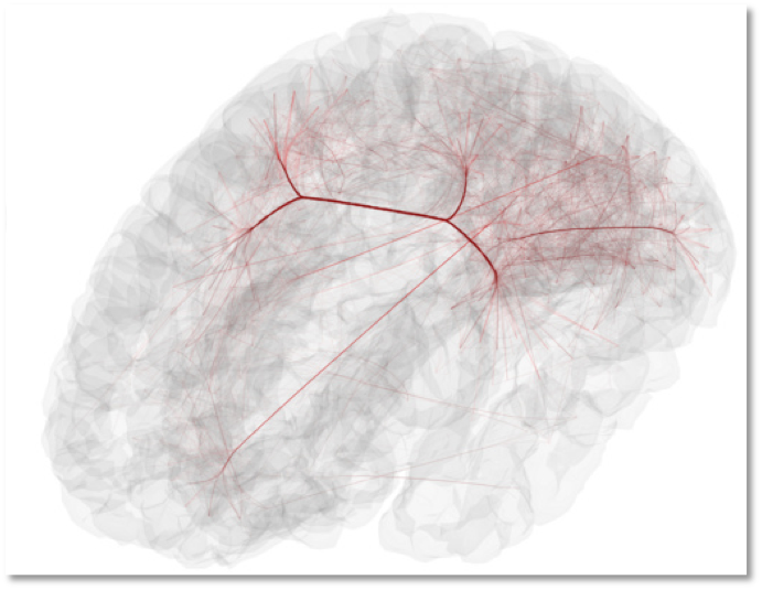 Human brain